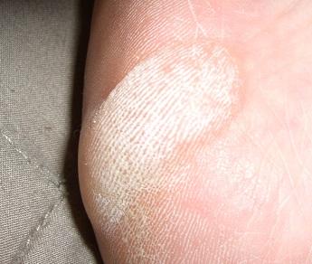 Meine erste Blase in Paris